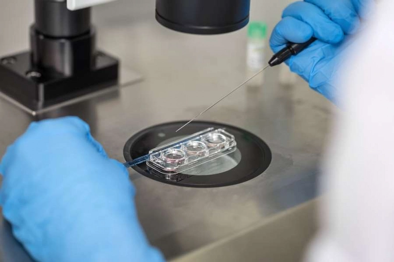 تصویری از ivf - دکتر زهرا عبودی